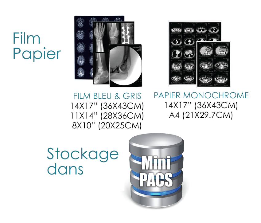 Film et papier ou magasin via Mini-PACS