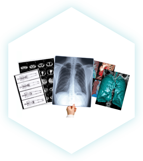 Wireless DR Retrofit